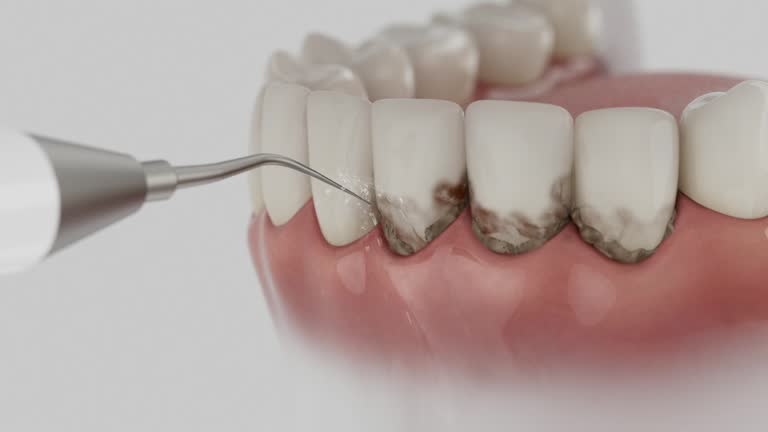 Reliable Dental Implants contractor in New Egypt, NJ by Smile Center Dentistry
